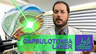 Capsulotomía láser Nd:YAG