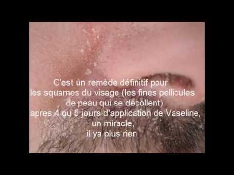 comment soigner squames