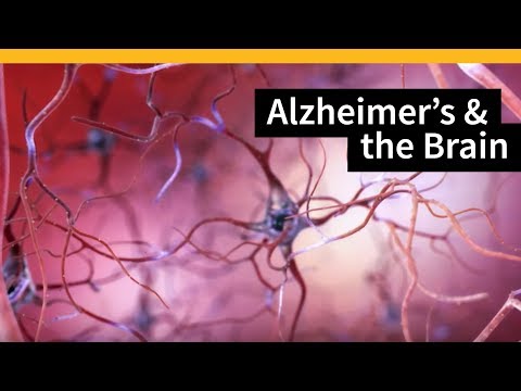 How Alzheimer’s Changes the Brain