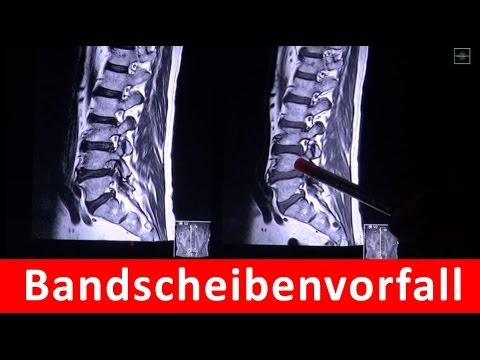 Ellenbogen Biopsie Injektionen für Schmerzen im Hüftgelenk intramuskulär