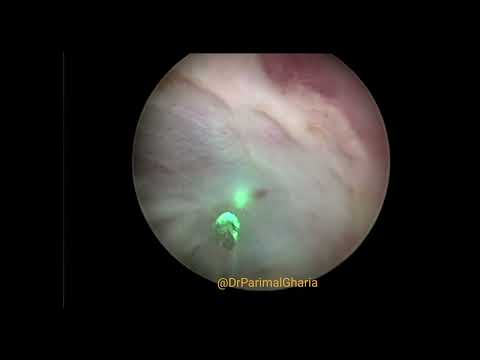 YouTube video