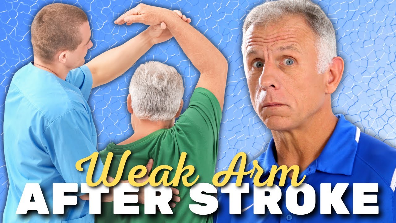 Exercises for Weak Arms after Stroke