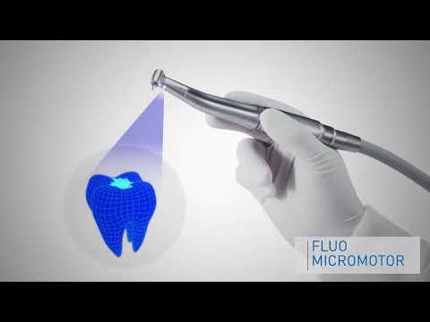 Watch Product Video