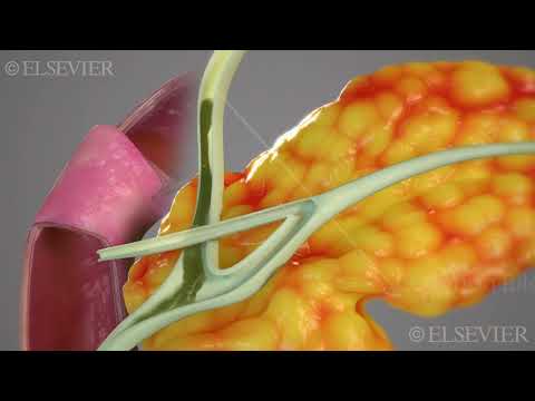 Bile and Pancreatic Duct