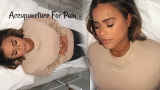 Getting Acupuncture For Pain