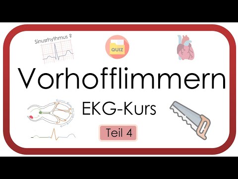 Vorhofflimmern sicher erkennen – EKG auswerten leicht gemacht  (Tachyarrhythmia absoluta, EKG-Kurs)