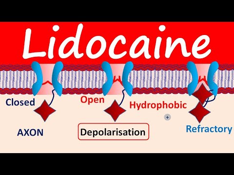Lidocaine as Local Anesthetic