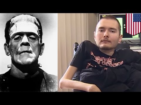 World's first head transplant planned by doctor who compares himself to Frankenstein - TomoNews
