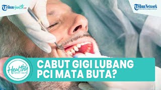 Mitos atau Fakta Cabut Gigi Berlubang Bisa Picu Kebutaan? Begini Penjelasan dari Dokter Gigi