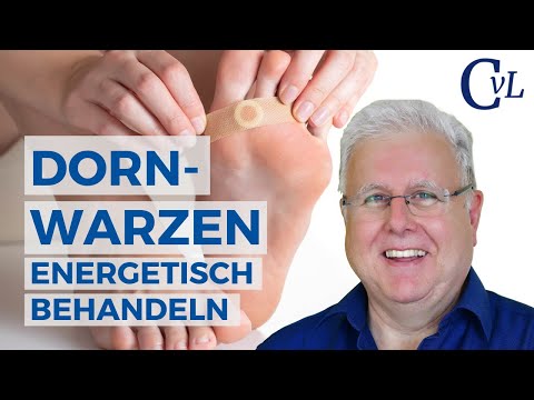 Dornwarzen energetisch behandeln