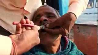 Hindistan'da sokakta diş tedavisi