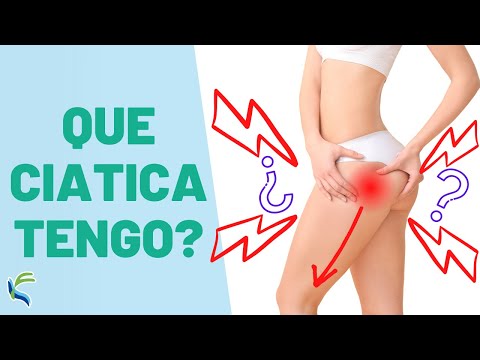 How to differentiate 🤔 the SCIATICA ⚡ from a FALSE SCIATICA 😫 Fisiolution