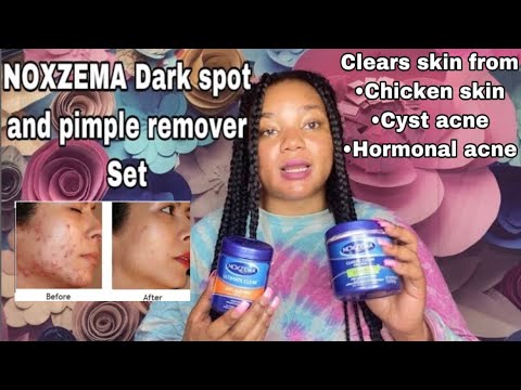 NOXZEMA DEEP CLEANSING CREAM+BLEMISH PADS FOR CLEARING ACNE & BRIGHTENING THE SKIN