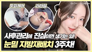 글로비지테라안티에이징의원 \u0026 스타힐링 사용 후기