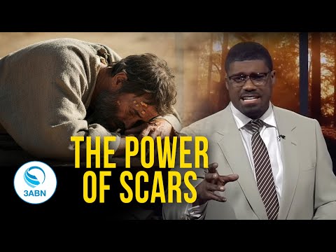 The Blessing in the Bruise | 3ABN Worship Hour