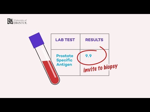 Prostatitis treatments uk