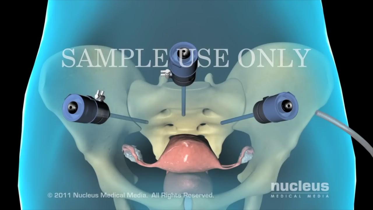 César Felipe Ploneda Valencia-20