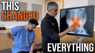 He Thought It Was an L5-S1 Disc… Dr. Rahim Found a Tailbone & Pelvis Injury