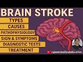 Brain Stroke Types Causes Pathophysiology Symptoms Diagnose Treatment