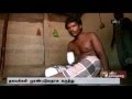Dalit youth's right arm, leg chopped case: FIR filed