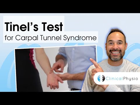 Tinel's Test for Carpal Tunnel Syndrome | Clinical Physio