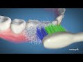 How to Use the Waterpik™ Sensonic™ toothbrush