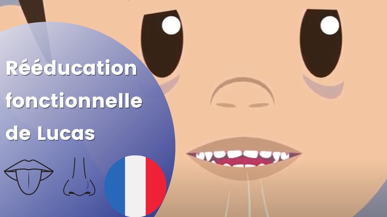 Pourquoi ai-je besoin de rééducation fonctionnelle ? - Froggymouth