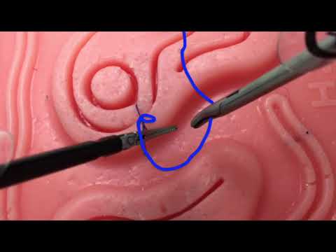 Laparoskopia - wiązanie techniką "Drop Needle"