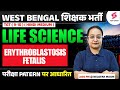 WBSSC SLST 2025 Life Science Classes 2025 Erythroblastosis Fetalis By Nilofar Mam