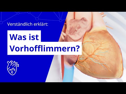 Verständlich erklärt: Was ist Vorhofflimmern?