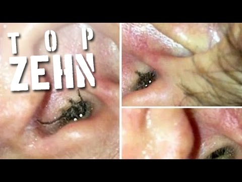 Gribki auf den Beinen die Volksmedizin Wie den Nagel des Beines von gribka zu heilen