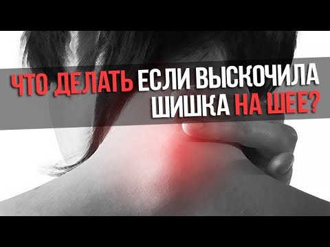 Боли при хандрозах спины Средства от боли в суставах при беременности