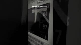 Мамопластика (Збільшення грудей) 23