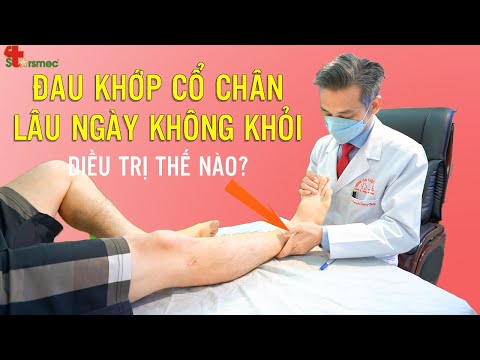 Đau cổ chân lâu ngày không khỏi - Điều trị thế nào? | Bác sĩ Thể thao Nguyễn Trọng Thuỷ