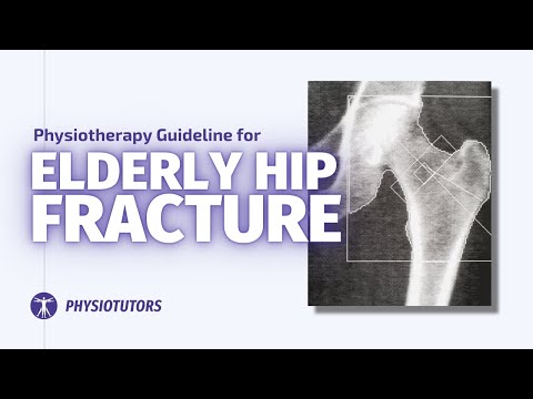 How to treat hip fractures in the elderly | Physiotherapy Guideline Review