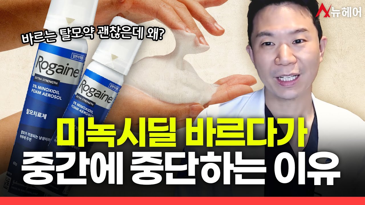 미녹시딜 바르다가 갑자기 중단하는 이유ㅣ뉴헤어