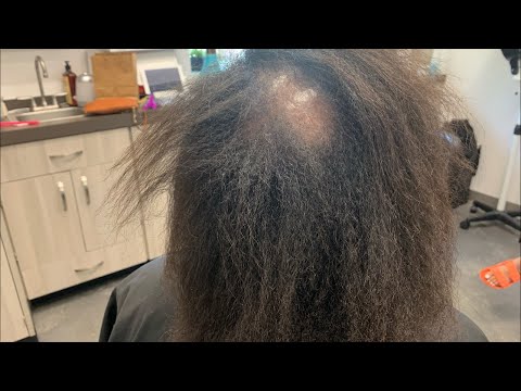 How to fix damaged hair| bald spot in middle plus more Video