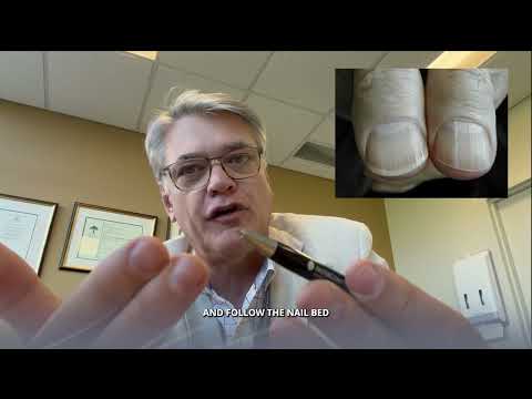 Restoring Damaged Nail Beds: Accurate Steps for Recovery