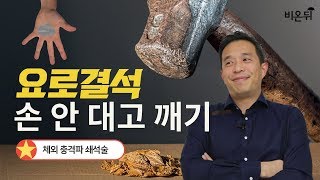 [메디텔 짤방] 요로결석 손 안 대고 깨기 with 장진석 원장