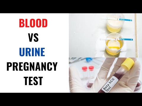 TEST DI GRAVIDANZA SU SANGUE O SU URINE: Quale è più sensibile? Test di gravidanza su siero e urine