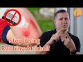 Stop Using Rubbing Alcohol Isopropyl Alcohol Voyage Direct Primary Care
