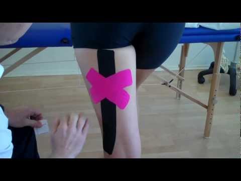 How to apply Kinesiology Taping to treat a Hamstring muscle strain Video