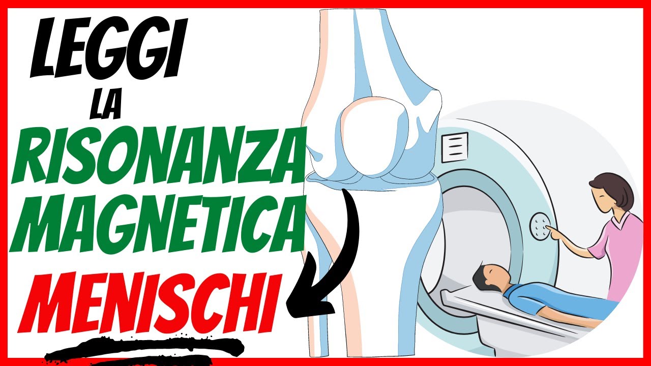 Watch Now Risonanza magnetica: come LEGGERLA | I MENISCHI | episodio 2 Risonanza magnetica: come LEGGERLA | I MENISCHI | episodio 2