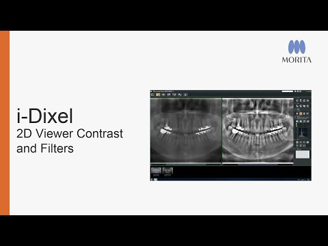 i-Dixel 2D Viewer - Adjusting Contrast and Filters