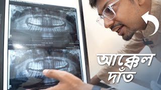 আক্কেল দাঁত উঠার এক্সপিরিয়েন্স I White Flag