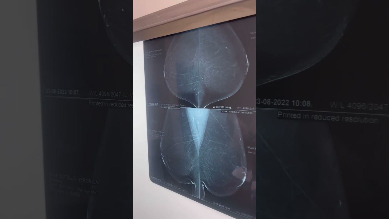 Luis Fernando Rodriguez Martinez-1