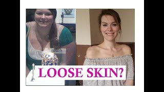 Keto:  What About Loose Skin?