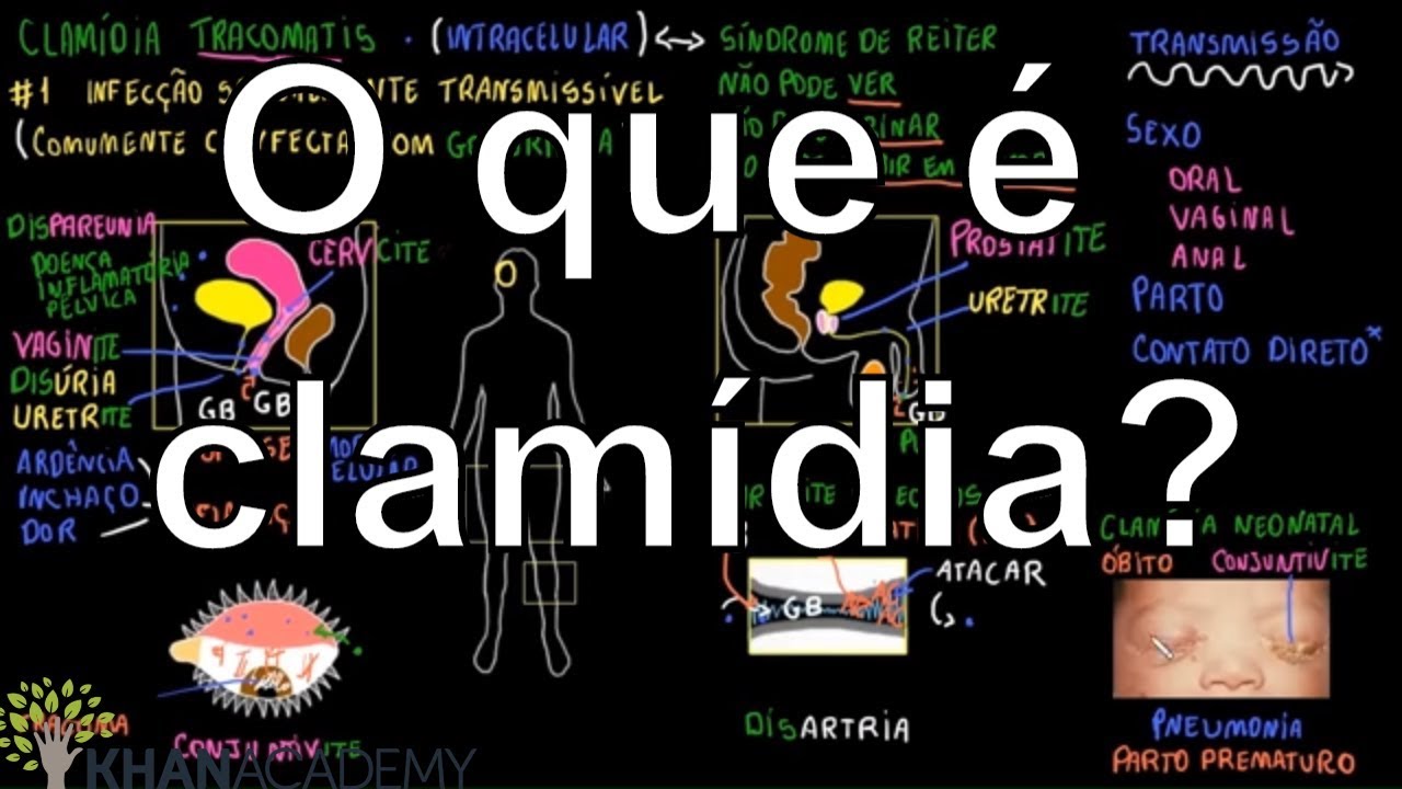 O que é clamídia? | Vida e evolução | Khan Academy