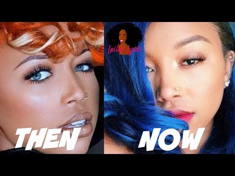 Tiny's Daughter Zonnique May Have Had Eye Color Implants REMOVED!