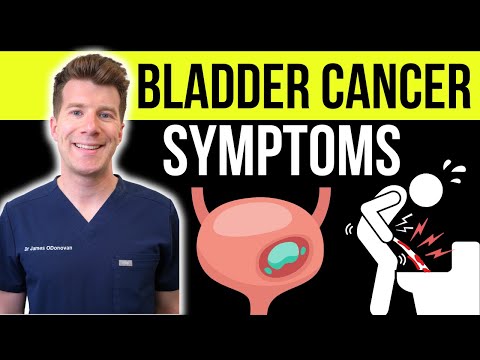 Bladder Cancer Signs and Symptoms (what to look out for)